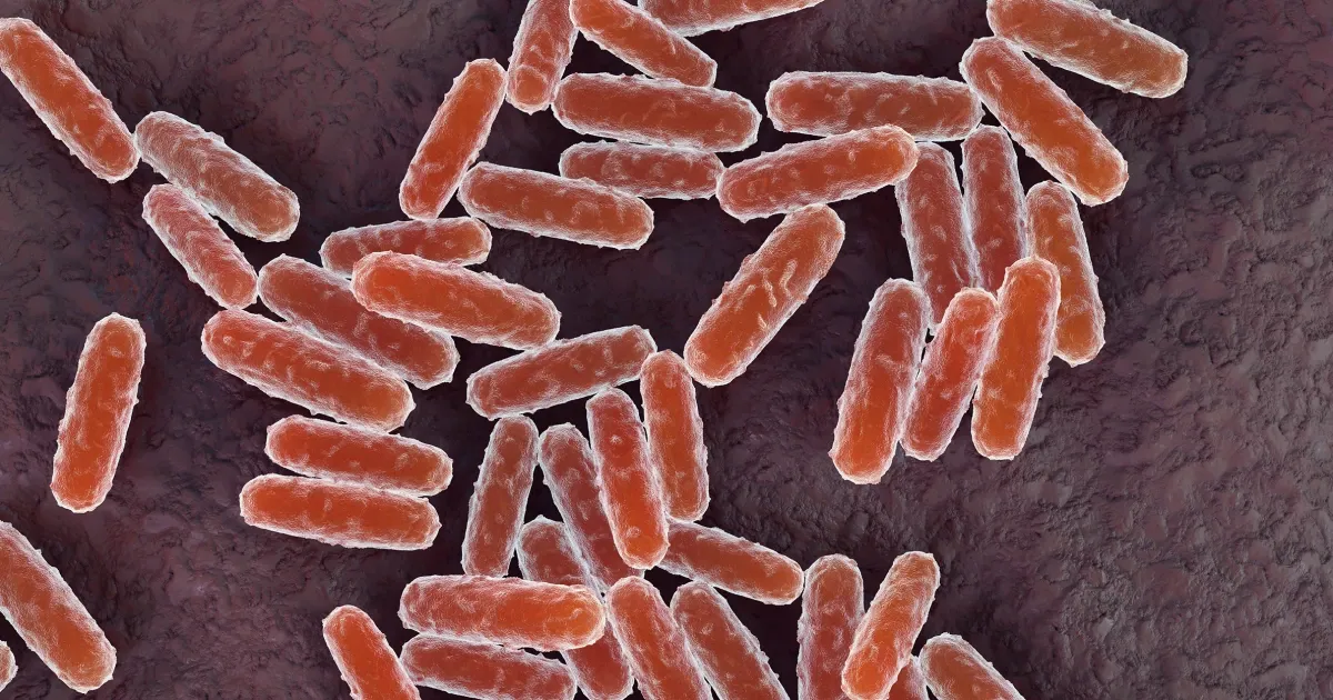 Russian lab worker dies of suspected pneumonic plague in Irkutsk